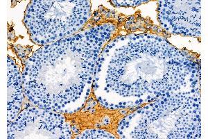 ABIN6261523 and ABIN6277133 at 1/100 staining Mouse testis tissue by IHC-P. (ELSPBP1 抗体  (C-Term))