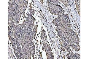 IHC analysis of PC4/SUB1 using anti-PC4/SUB1 antibody (ABIN4886733).
