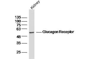 Mouse kidney lysates probed with Glucagon Receptor Polyclonal Antibody, unconjugated  at 1:300 overnight at 4°C followed by a conjugated secondary antibody for 60 minutes at 37°C. (Glucagon Receptor 抗体  (AA 11-110))