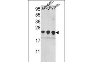 Western Blotting (WB) image for anti-Peroxiredoxin 2 (PRDX2) (AA 169-198), (C-Term) antibody (ABIN389468)