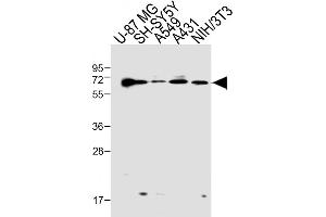 All lanes : Anti-Epsin2/1 Antibody (N-term) at 1:1000 dilution Lane 1: U-87 MG whole cell lysate Lane 2: SH-SY5Y whole cell lysate Lane 3: A549 whole cell lysate Lane 4: A431 whole cell lysate Lane 5: NIH/3T3 whole cell lysate Lysates/proteins at 20 μg per lane. (Epsin 2 抗体  (N-Term))