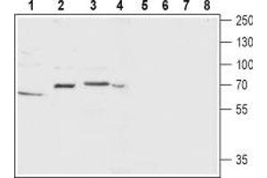 Western blot analysis of rat ovary (lanes 1 and 5), rat brain (lanes 2 and 6), mouse brain membrane (lanes 3 and 7) and SH-SY5Y (lanes 4 and 8) lysate: - 1-4. (TACR1 抗体  (2nd Extracellular Loop))