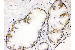 Immunohistochemistry (IHC) image for anti-CD46 (CD46) (AA 366-392), (C-Term) antibody (ABIN3043806)