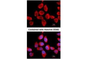 ICC/IF Image Immunofluorescence analysis of methanol-fixed A431, using RPLP2, antibody at 1:500 dilution. (RPLP2 抗体  (Center))