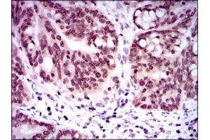 Image no. 5 for anti-Nuclear Receptor Subfamily 6, Group A, Member 1 (NR6A1) antibody (ABIN1491624)