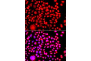 Immunofluorescence analysis of A549 cell using TESK2 antibody. (TESK2 抗体)
