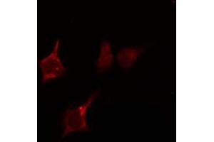 ABIN6274043 staining HepG2 by IF/ICC. (RhoA,B,C 抗体)
