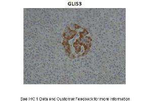 Sample Type :  Human Pancreas  Primary Antibody Dilution :  1:10  Secondary Antibody :  Anti-rabbit HRP  Secondary Antibody Dilution :  1:1000  Gene Name :  GLIS3  Submitted by :  Anonymous (GLIS3 抗体  (N-Term))