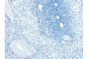 Immunohistochemistry (IHC) image for anti-Arachidonate 5-Lipoxygenase-Activating Protein (ALOX5AP) (C-Term) antibody (ABIN185249)