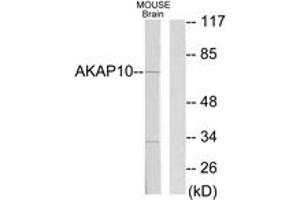 Western blot analysis of extracts from mouse brain cells, using AKAP10 Antibody. (AKAP10 抗体  (AA 10-59))