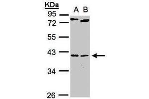 WB Image Sample(30 ug whole cell lysate) A:H1299 B:Raji , 10% SDS PAGE antibody diluted at 1:1000 (NK2 Homeobox 5 抗体)