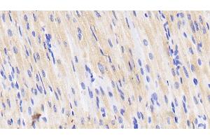 Detection of CD40L in Porcine Cardiac Muscle Tissue using Polyclonal Antibody to Cluster Of Differentiation 40 Ligand (CD40L) (CD40 Ligand 抗体  (AA 111-261))