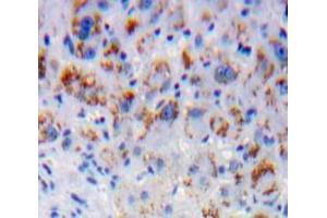 IHC-P analysis of Liver tissue, with DAB staining. (CD1d 抗体  (AA 32-302))