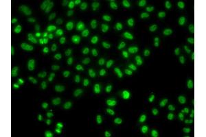 Immunofluorescence analysis of HeLa cells using LHX8 antibody (ABIN6293049). (LHX8 抗体)