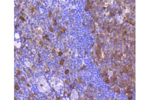 Paraformaldehyde-fixed, paraffin embedded human tonsil section, Antigen retrieval by boiling in sodium citrate buffer (pH6) for 15min, Block endogenous peroxidase by 3% hydrogen peroxide for 30 minutes, Blocking buffer (normal serum) at 37°C for 20min, Antibody incubation with Cdk6 (4F7) Monoclonal Antibody  at 1:50 overnight at 4°C, followed by a conjugated secondary and DAB staining. (CDK6 抗体)