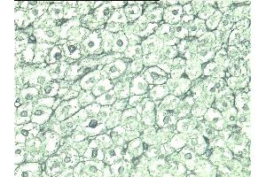 Poly(ADP-ribose) staining of rat liver.