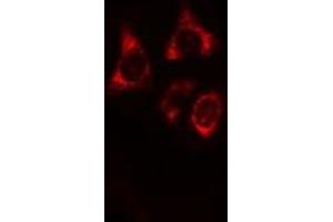 ABIN6269358 staining HeLa cells by IF/ICC. (IRF3 抗体  (C-Term))