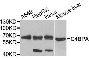 Western blot analysis of extracts of various cells, using C4BPA antibody. (C4BPA 抗体)