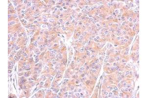 Immunohistochemistry (IHC) image for anti-Tubulin, beta (TUBB) antibody (ABIN2854998)