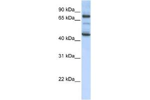 WB Suggested Anti-GAS2L1 Antibody Titration: 0. (GAS2L1 抗体  (Middle Region))