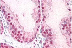 Immunohistochemistry (IHC) image for anti-Poly-U Binding Splicing Factor 60KDa (PUF60) (C-Term) antibody (ABIN184855)