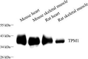 Western blot analysis of TPM1 (ABIN7076030),at dilution of 1: 400 (Tropomyosin 抗体)