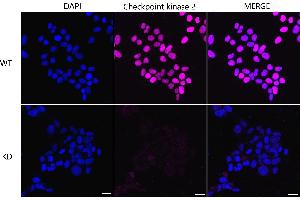 Immunocytochemical staining of Hela cells using Checkpoint kinase 2 antibody (ABIN7798039), 1:1,000), Top panel: wild-type (WT), Bottom panal: Checkpoint kinase 2 shRNA knockdown (KD). (Recombinant CHEK2 抗体)