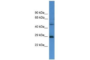 WB Suggested Anti-SPR  Antibody Titration: 0. (SPR 抗体  (C-Term))