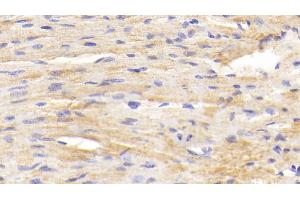 Immunohistochemistry (IHC) image for anti-beta-Site APP-Cleaving Enzyme 2 (BACE2) (AA 242-502) antibody (ABIN7438730)
