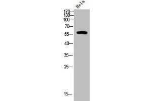 Western Blot analysis of Hela cells using Phospho-PFK-2 car (S483) Polyclonal Antibody (PFKFB2 抗体  (pSer483))