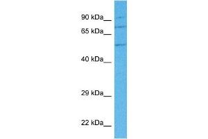 Host:  Rabbit  Target Name:  ANXA7  Sample Tissue:  Human 786-0 Whole Cell  Antibody Dilution:  1ug/ml (Annexin VII 抗体  (N-Term))