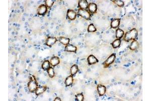 IHC testing of FFPE mouse kidney with CYP1B1 antibody.