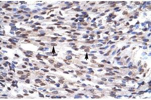 Human Heart; Rabbit Anti-GFI1B Antibody. (GFI1B 抗体  (N-Term))