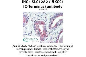 Image no. 1 for anti-Solute Carrier Family 12 (Potassium-Chloride Transporter) Member 2 (SLC12A2) (C-Term) antibody (ABIN1739325) (SLC12A2 抗体  (C-Term))
