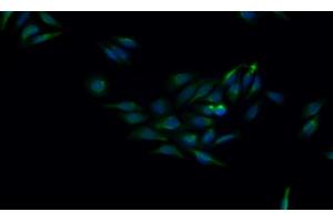 Detection of CTSK in Human HepG2 cell using Monoclonal Antibody to Cathepsin K (CTSK) (Cathepsin K 抗体  (AA 115-329))
