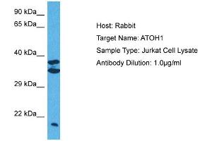 Host:  Rabbit  Target Name:  ATOH1  Sample Tissue:  Human Jurkat Whole Cell  Antibody Dilution:  1ug/ml (ATOH1 抗体  (Middle Region))