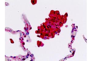 Anti-SELL / L-Selectin / CD62L antibody IHC staining of human lung, macrophages. (L-Selectin 抗体  (AA 346-372))