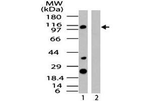 Western blot analysis of human IPO8 in HeLa cell lysate in the 1) absence and 2) presence of immunizing peptide. (Importin 8 抗体  (AA 850-900))