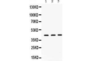 Western blot analysis of ORM1 expression in rat liver extract ( Lane 1), mouse liver extract ( Lane 2) and PANC whole cell lysates ( Lane 3). (ORM1 抗体  (AA 19-201))