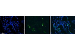 Rabbit Anti-RNASET2 Antibody     Formalin Fixed Paraffin Embedded Tissue: Human Lung Tissue  Observed Staining: Cytoplasmic in in alveolar cells, type I and II  Primary Antibody Concentration: 1:100  Other Working Concentrations: 1/600  Secondary Antibody: Donkey anti-Rabbit-Cy3  Secondary Antibody Concentration: 1:200  Magnification: 20X  Exposure Time: 0. (RNASET2 抗体  (Middle Region))