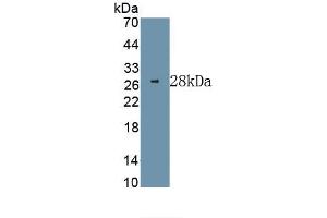Detection of Recombinant ERK1, Human using Monoclonal Antibody to Extracellular Signal Regulated Kinase 1 (ERK1) (ERK1 抗体  (AA 75-312))