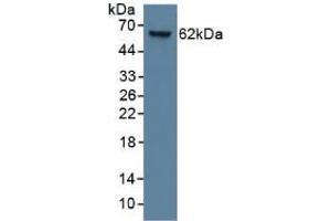 Mouse Capture antibody from the kit in WB with Positive Control: Human lung lysate. (KRT9 ELISA 试剂盒)