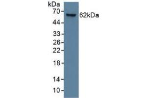 Western Blotting (WB) image for Keratin 9 (KRT9) ELISA Kit (ABIN6720501)