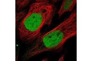 Immunofluorescent staining of human cell line U-2 OS with KIF4A polyclonal antibody  at 1-4 ug/mL dilution shows positivity in nucleus. (KIF4A 抗体)