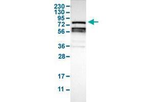 Western Blot analysis of human cell line RT-4 with RIPK1 polyclonal antibody . (RIPK1 抗体  (AA 306-449))