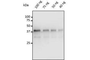 Anti-Pepsin Ab at 1/500 dilution, 40-100 ng of Pepsin isolated from porcine gastric mucosa, rabbit polyclonal to goat lgG (HRP) at 1/10,000 dilution, (Pepsin 抗体)