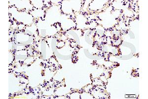 Formalin-fixed and mouse brain tissue labeled with Anti-IL12RB2 Polyclonal Antibody (ABIN747878), Unconjugated at 1:200 followed by conjugation to the secondary antibody and DAB staining (IL12RB2 抗体  (AA 301-400))
