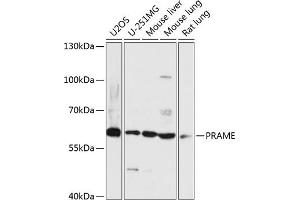 Western blot analysis of extracts of various cell lines, using PRAME antibody (ABIN7269507) at 1:3000 dilution. (PRAME 抗体  (AA 1-200))