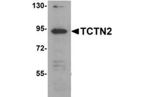 Western blot analysis of TCTN2 in SK-N-SH cell lysate with TCTN2 antibody at 1 μg/ml.