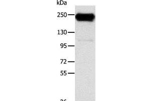 Western Blot analysis of K562 cell using RRBP1 Polyclonal Antibody at dilution of 1:400 (RRBP1 抗体)